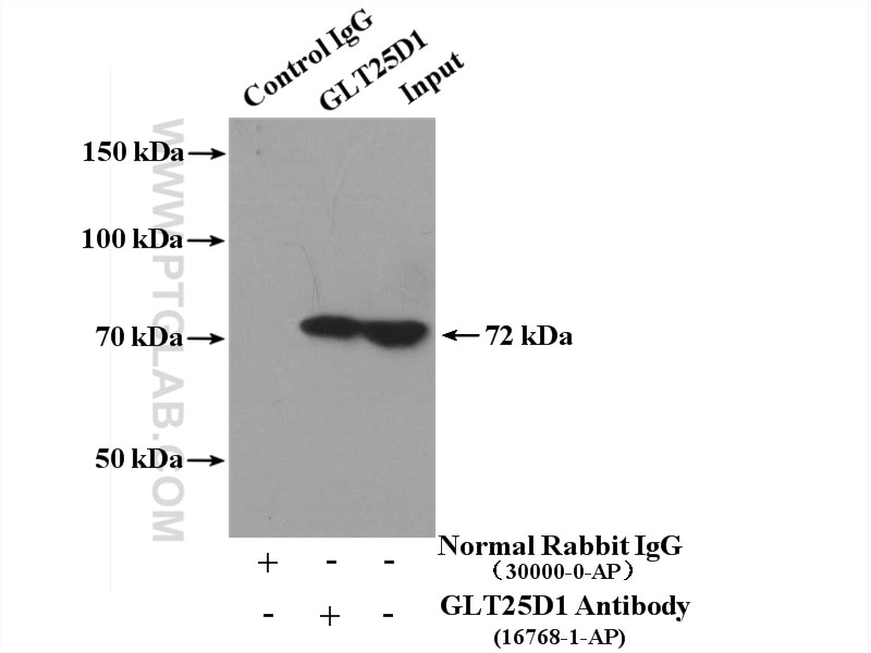 Immunoprecipitation (IP) experiment of HeLa cells using GLT25D1 Polyclonal antibody (16768-1-AP)