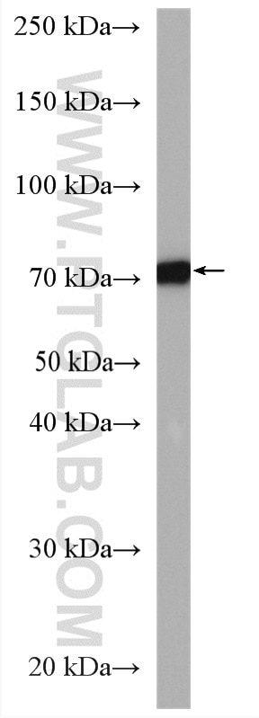 Western Blot (WB) analysis of SH-SY5Y cells using GLT25D1 Polyclonal antibody (16768-1-AP)