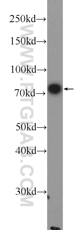 Western Blot (WB) analysis of HeLa cells using GLT25D1 Polyclonal antibody (16768-1-AP)