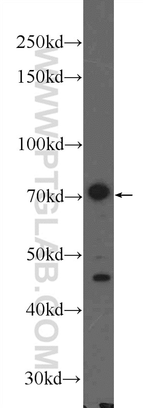 Western Blot (WB) analysis of SH-SY5Y cells using GLT25D1 Polyclonal antibody (16768-1-AP)