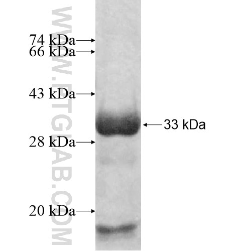 GLT25D1 fusion protein Ag10472 SDS-PAGE