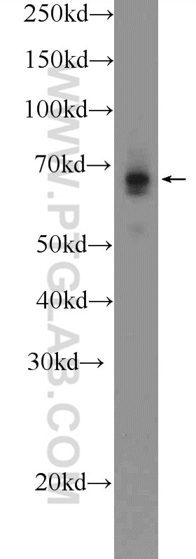 Western Blot (WB) analysis of Neuro-2a cells using GLT25D2 Polyclonal antibody (25993-1-AP)