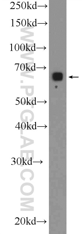 Western Blot (WB) analysis of SH-SY5Y cells using GLT25D2 Polyclonal antibody (25993-1-AP)