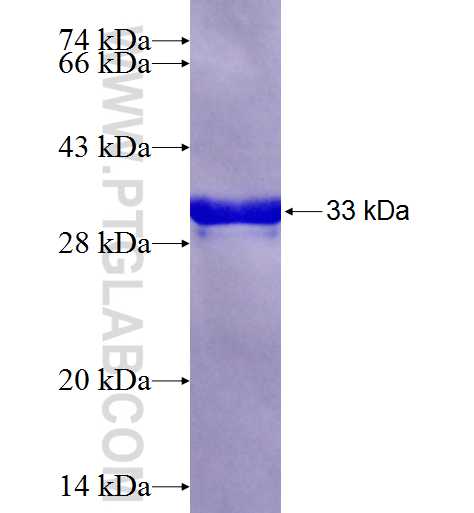 GLT25D2 fusion protein Ag23360 SDS-PAGE