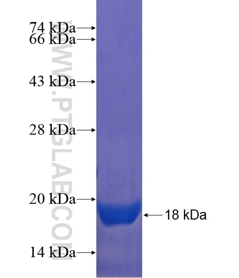 GLT8D1 fusion protein Ag21799 SDS-PAGE