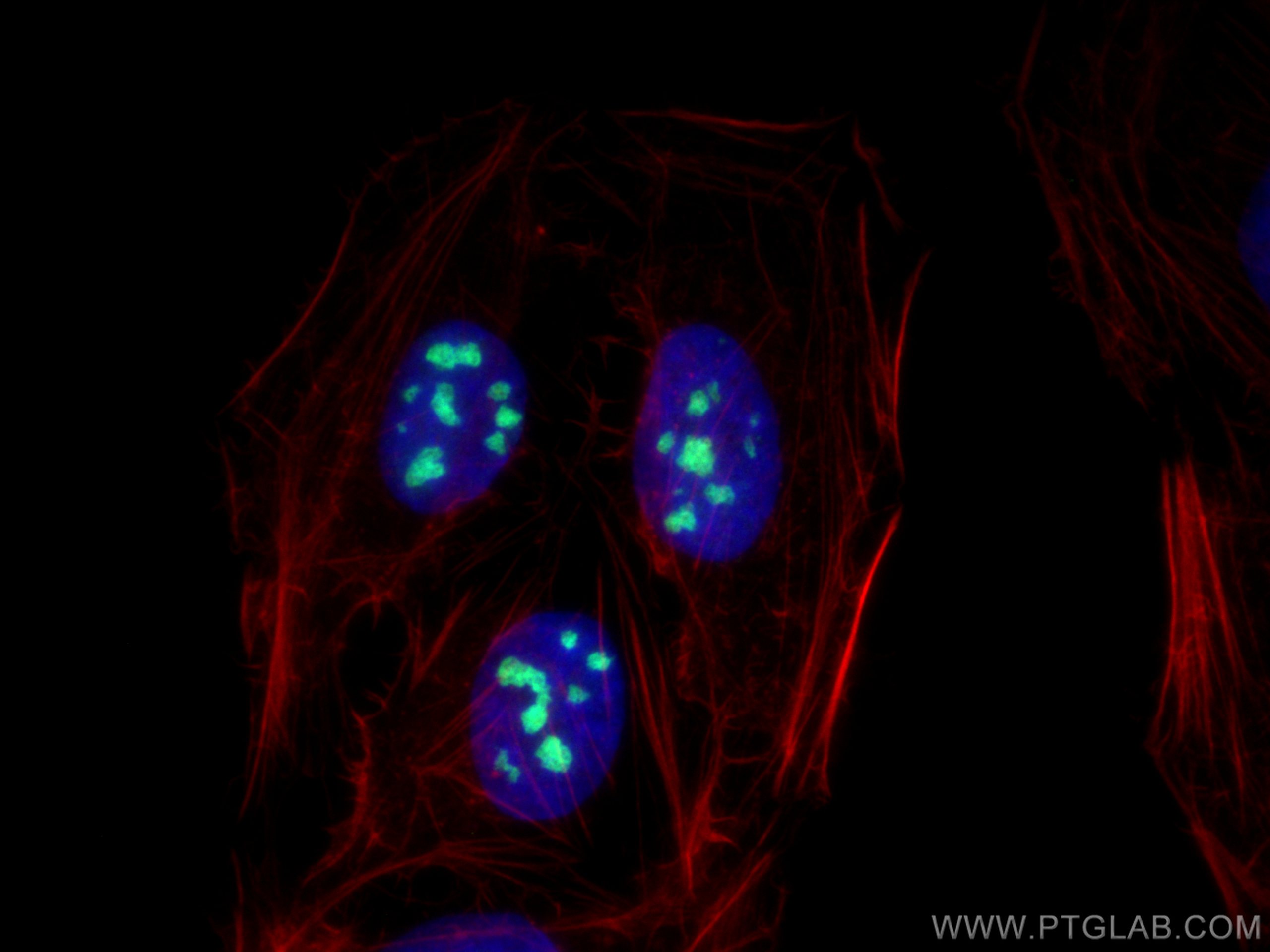 Immunofluorescence (IF) / fluorescent staining of U2OS cells using GLTSCR2 Polyclonal antibody (27353-1-AP)
