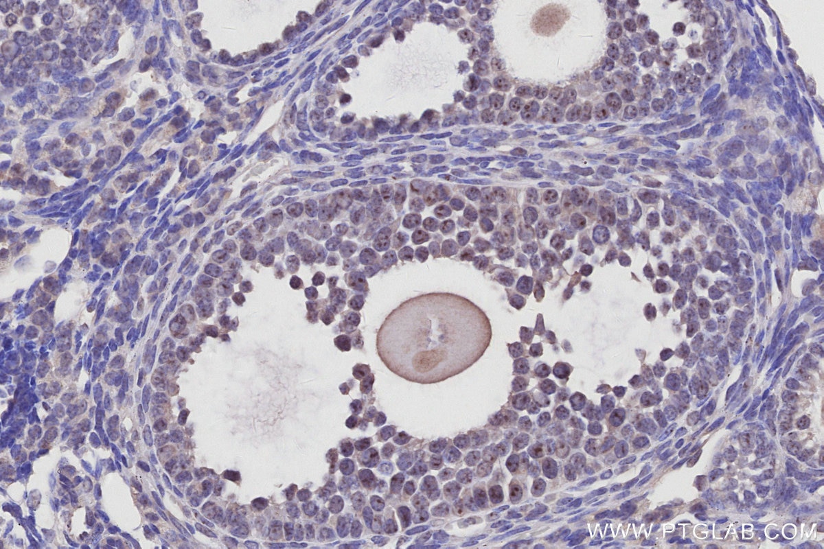 IHC staining of mouse ovary using 27353-1-AP Immunohistochemistry (IHC) staining of mouse ovary tissue using GLTSCR2 Polyclonal antibody (27353-1-AP)