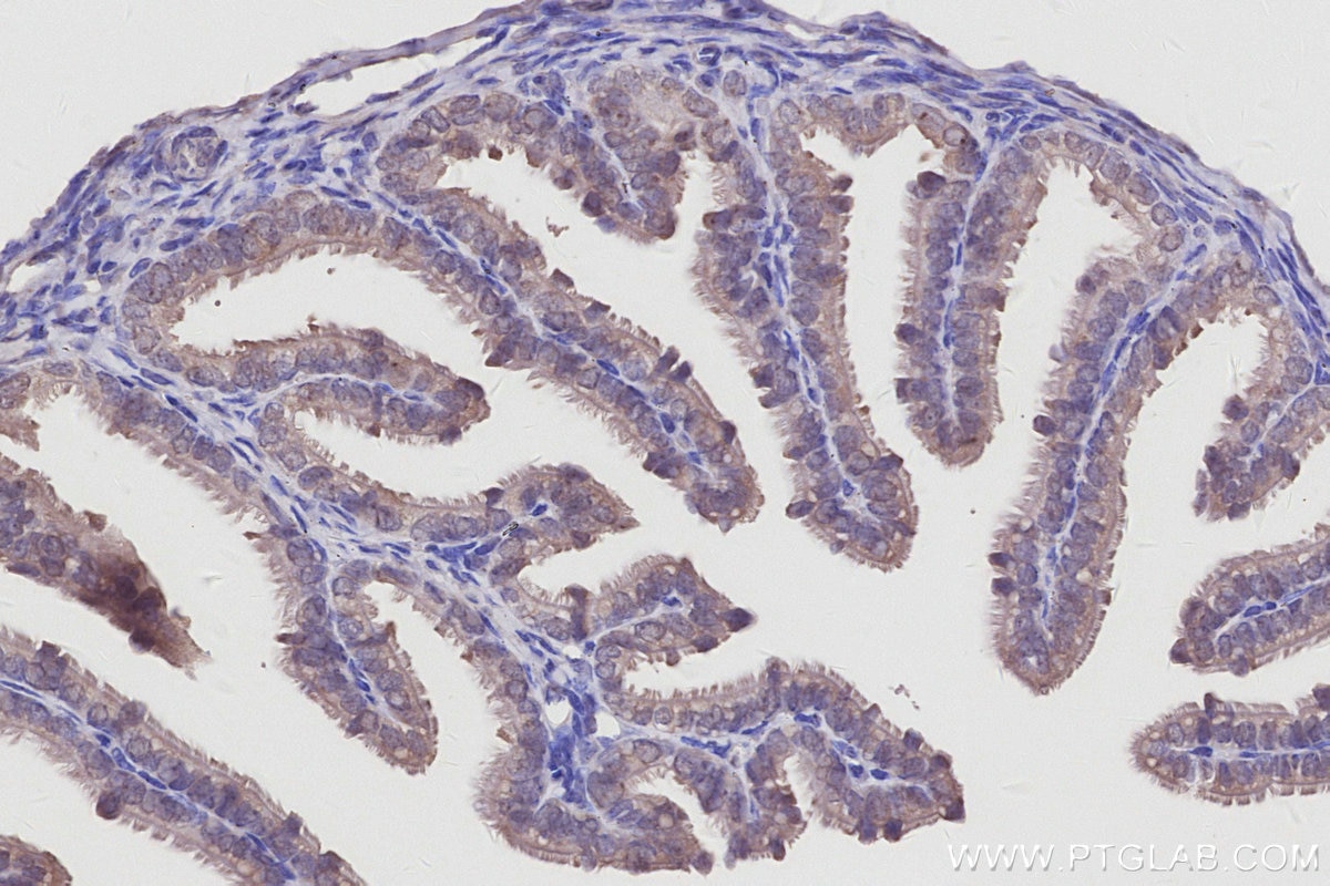 IHC staining of mouse ovary using 27353-1-AP Immunohistochemistry (IHC) staining of mouse ovary tissue using GLTSCR2 Polyclonal antibody (27353-1-AP)