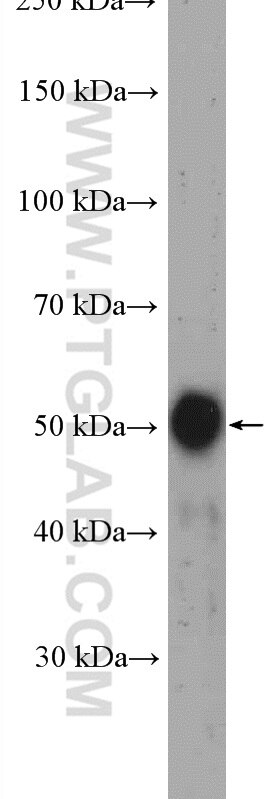 WB analysis of human placenta using 27353-1-AP