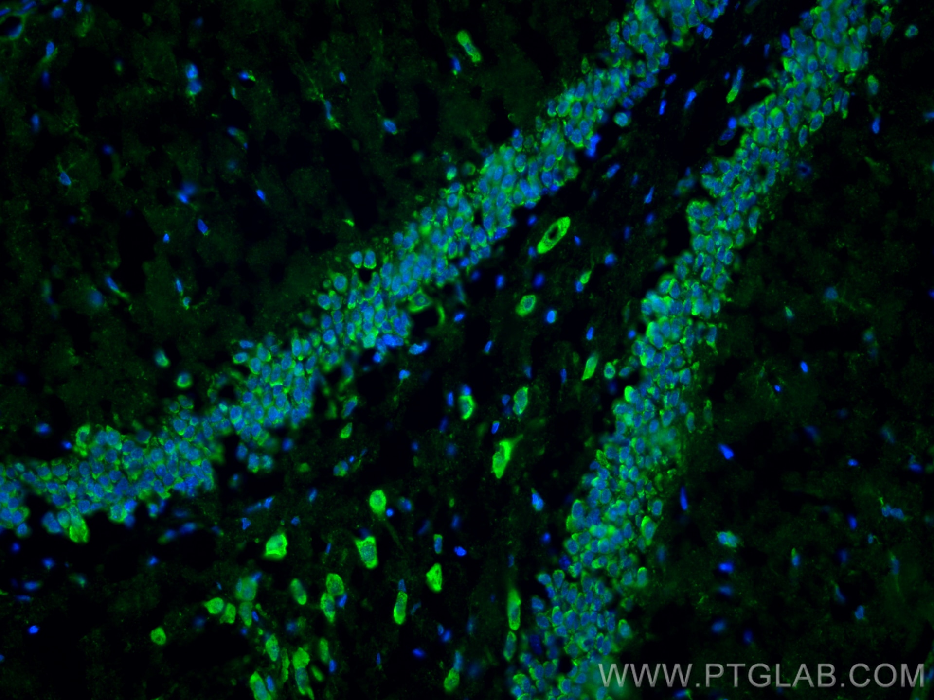 Immunofluorescence (IF) / fluorescent staining of rat brain tissue using GLUD1 Polyclonal antibody (14299-1-AP)