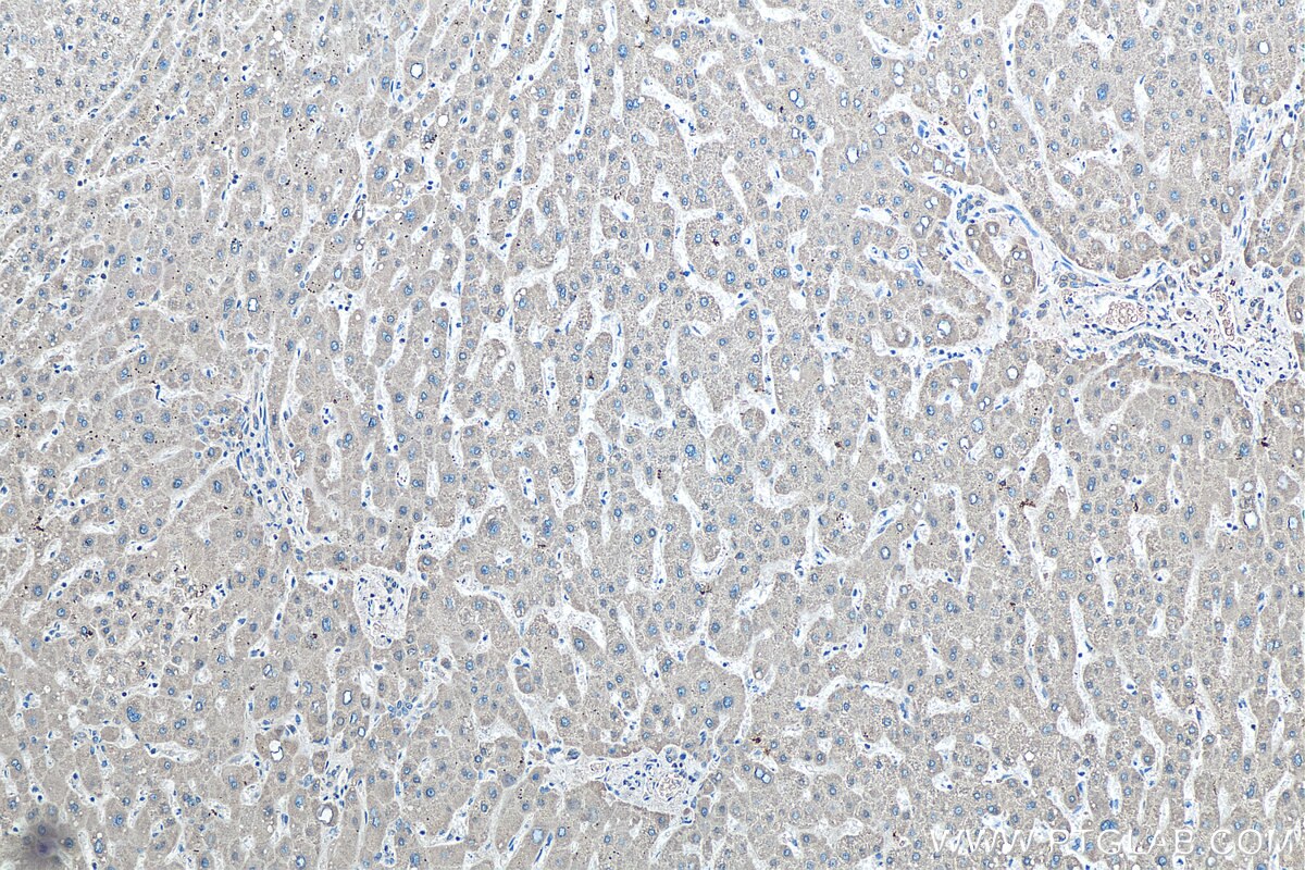 IHC staining of human liver using 14299-1-AP