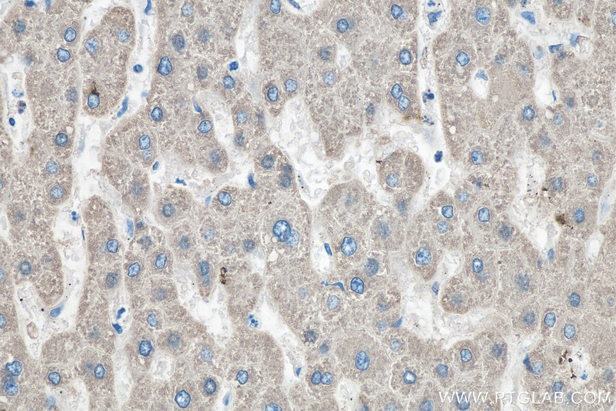 Immunohistochemistry (IHC) staining of human liver tissue using GLUD1 Polyclonal antibody (14299-1-AP)