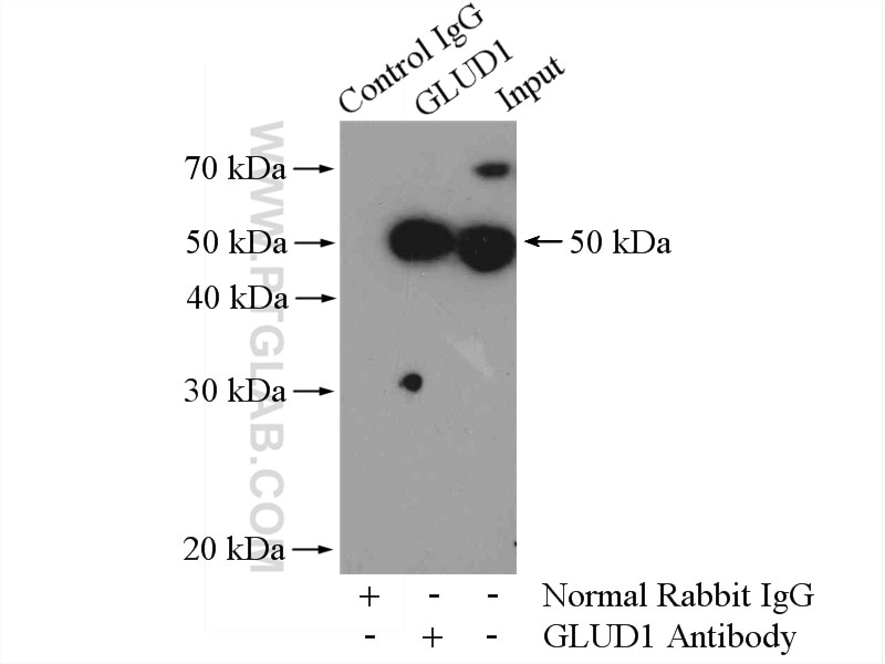 Immunoprecipitation (IP) experiment of HeLa cells using GLUD1 Polyclonal antibody (14299-1-AP)