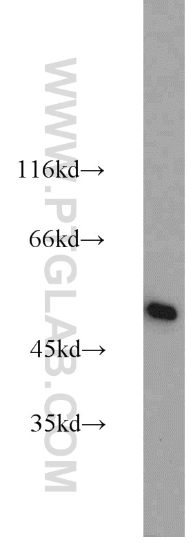 GLUD1 Polyclonal antibody