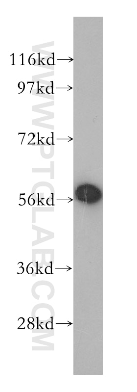 Western Blot (WB) analysis of mouse lung tissue using GLUD1 Polyclonal antibody (14299-1-AP)