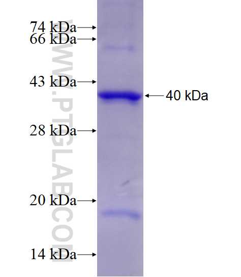 GLUD1 fusion protein Ag6179 SDS-PAGE