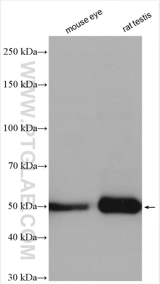 Western Blot (WB) analysis of various lysates using GLUD2 Polyclonal antibody (14462-1-AP)