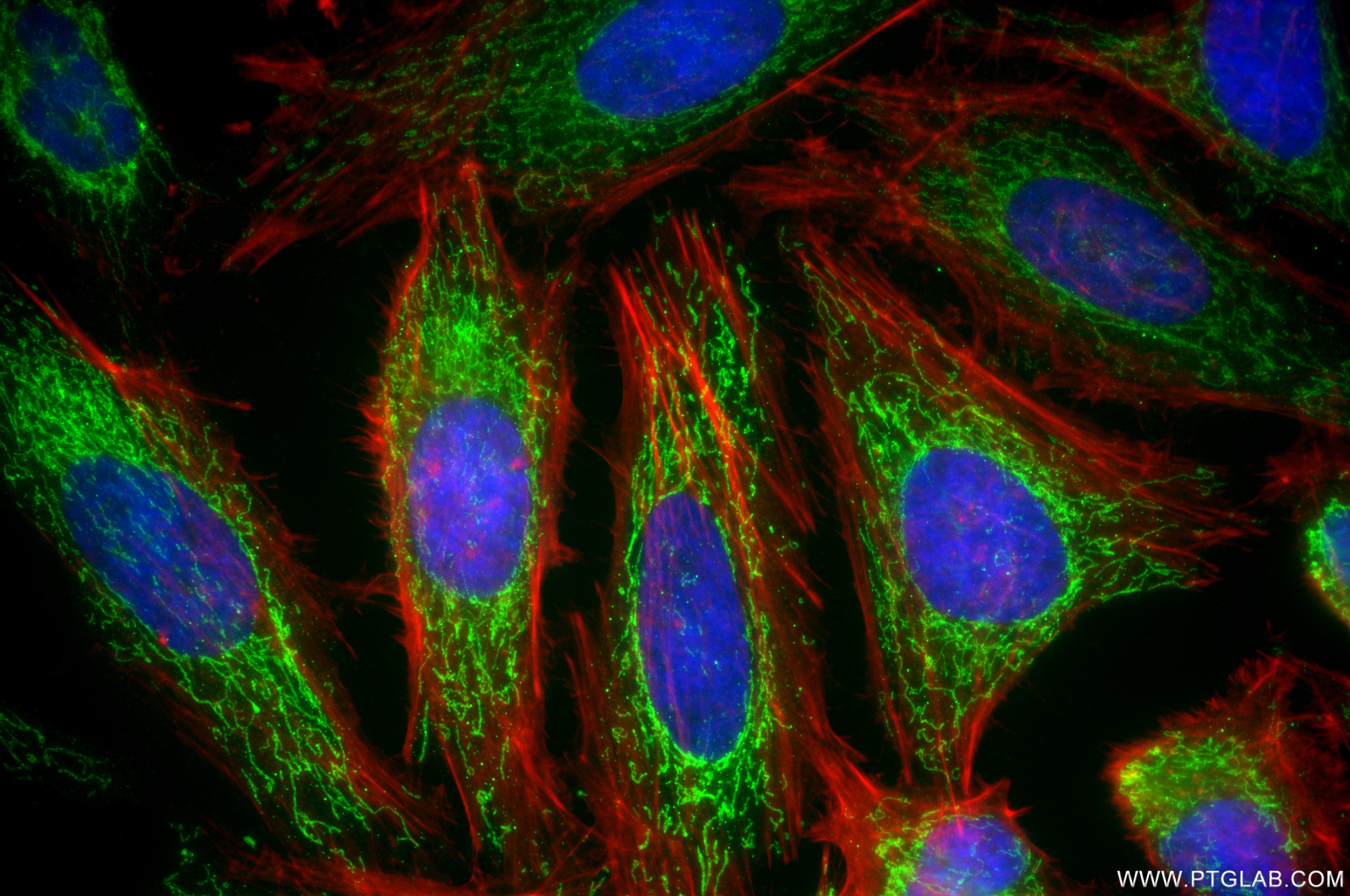 Immunofluorescence (IF) / fluorescent staining of HeLa cells using GLUD2 Recombinant monoclonal antibody (85602-5-RR)