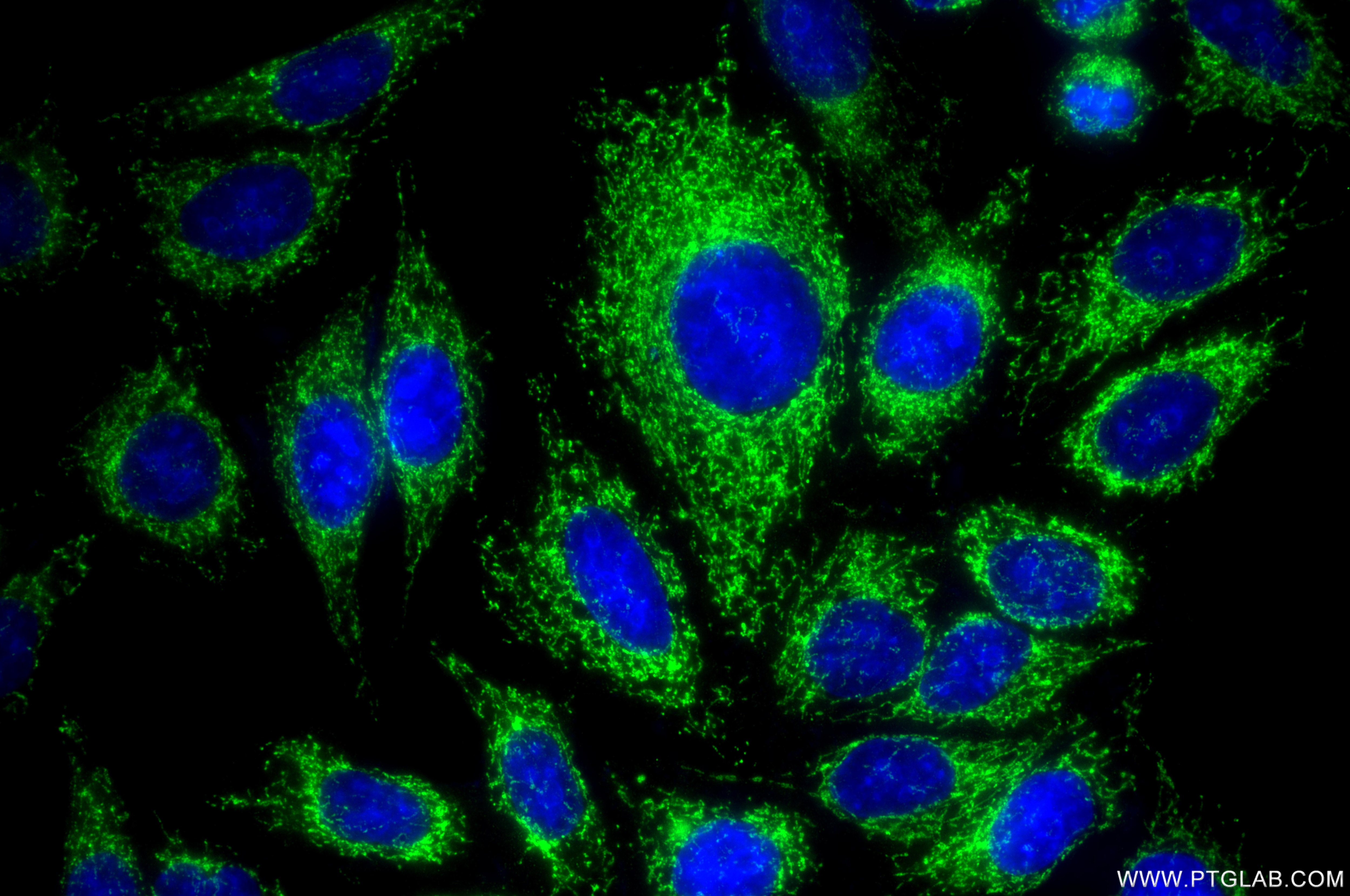 Immunofluorescence (IF) / fluorescent staining of HepG2 cells using GLUD2 Recombinant monoclonal antibody (85602-5-RR)