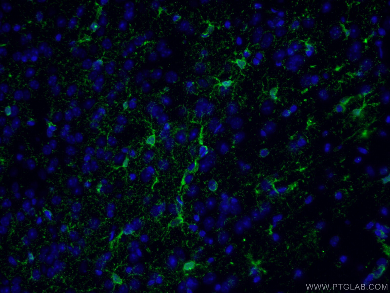 IF Staining of mouse brain using 11037-2-AP