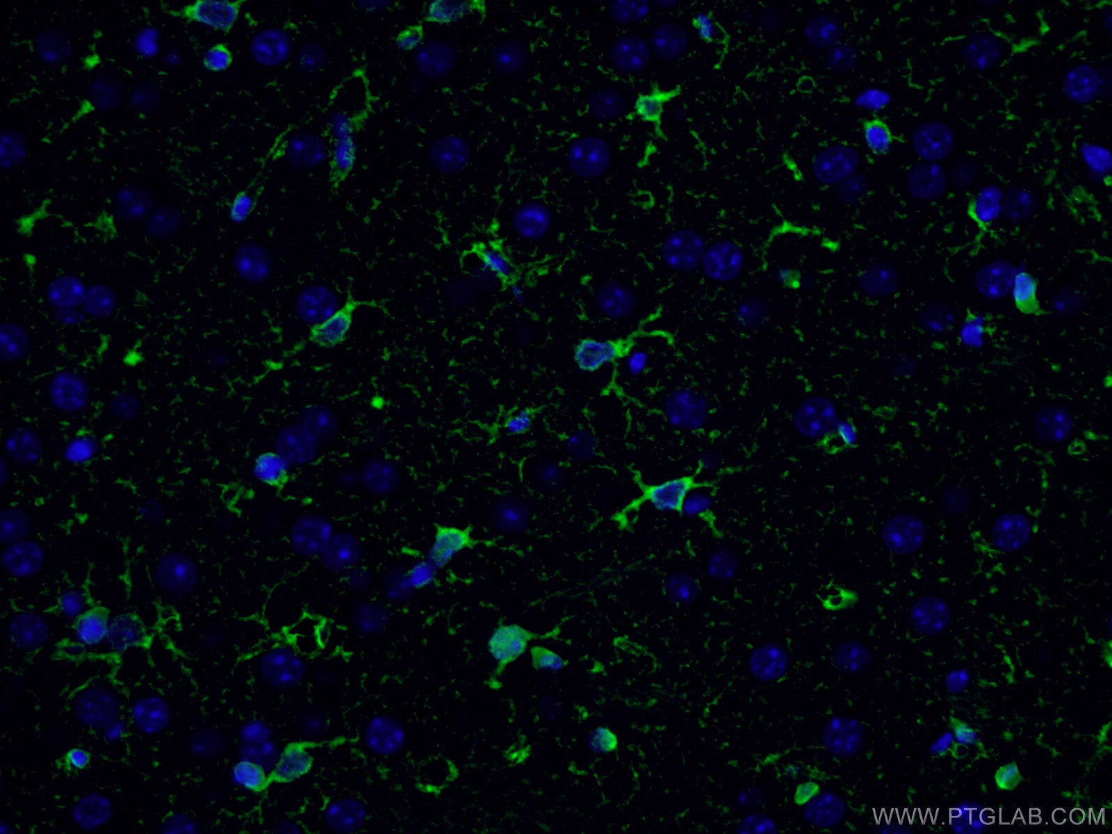 Immunofluorescence (IF) / fluorescent staining of human brain tissue using Glutamine Synthetase Polyclonal antibody (11037-2-AP)