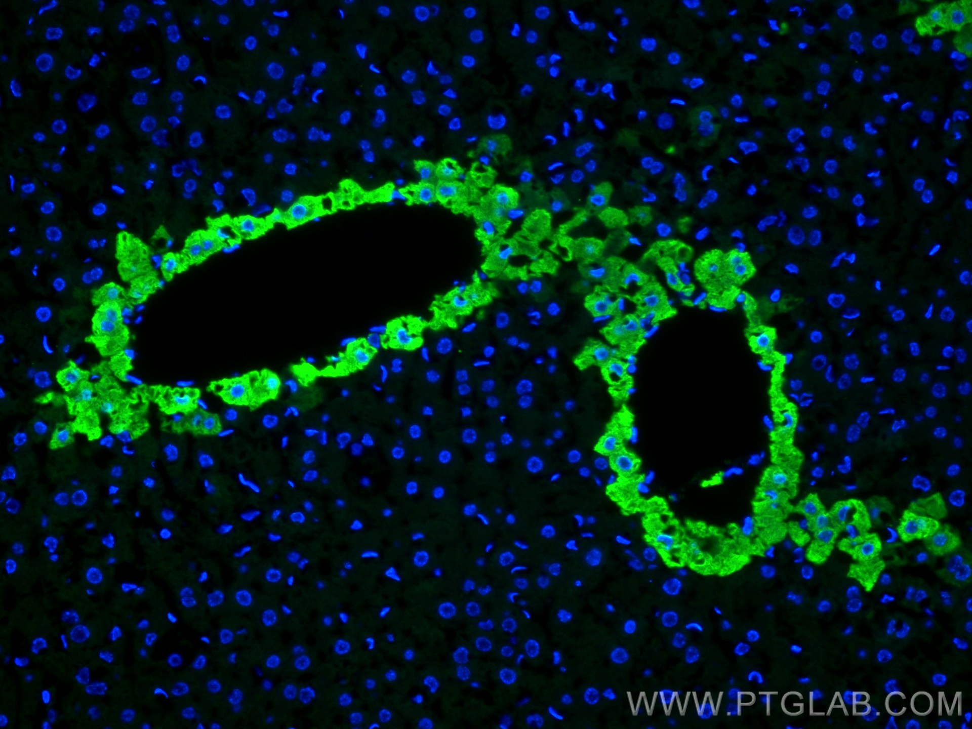 Immunofluorescence (IF) / fluorescent staining of mouse liver tissue using Glutamine Synthetase Polyclonal antibody (11037-2-AP)