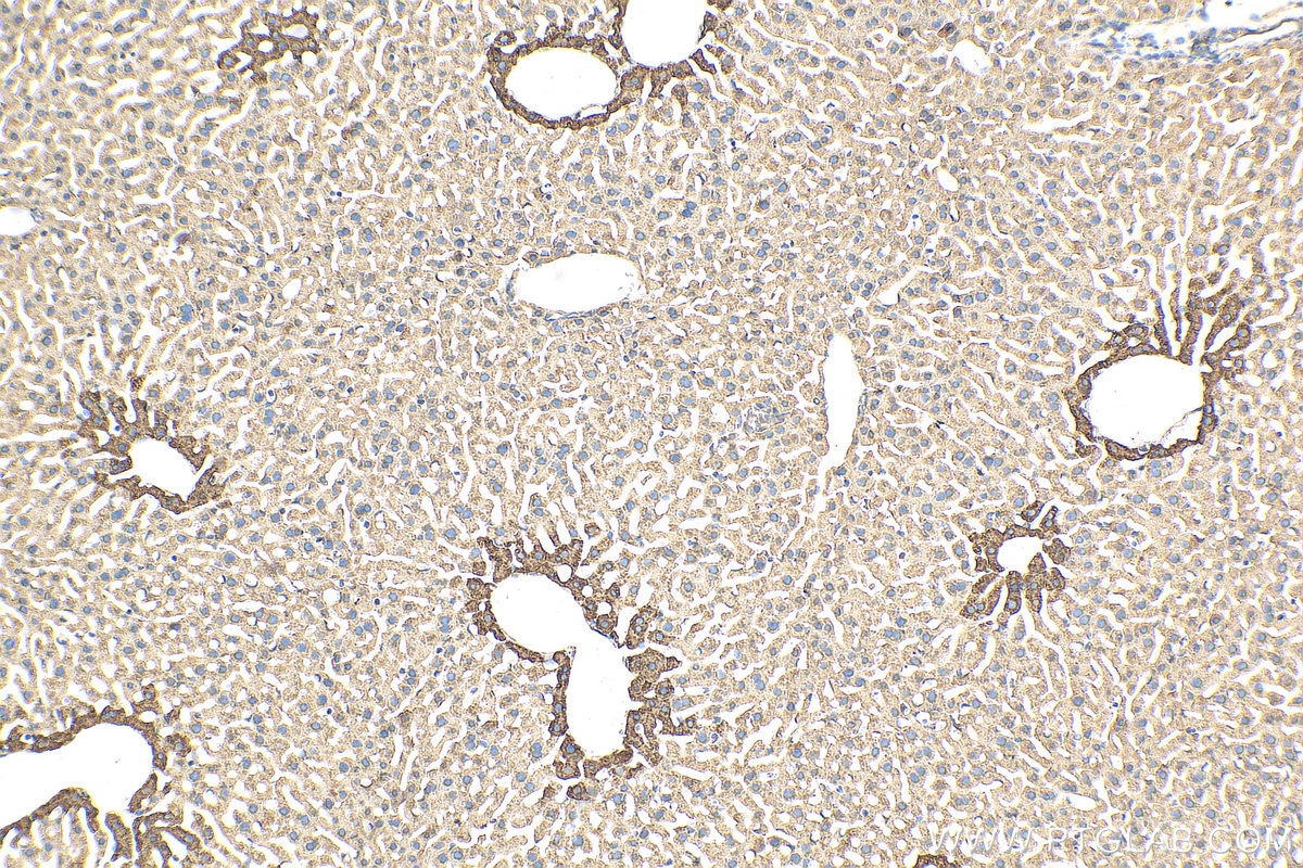 Immunohistochemistry (IHC) staining of mouse liver tissue using Glutamine Synthetase Polyclonal antibody (11037-2-AP)