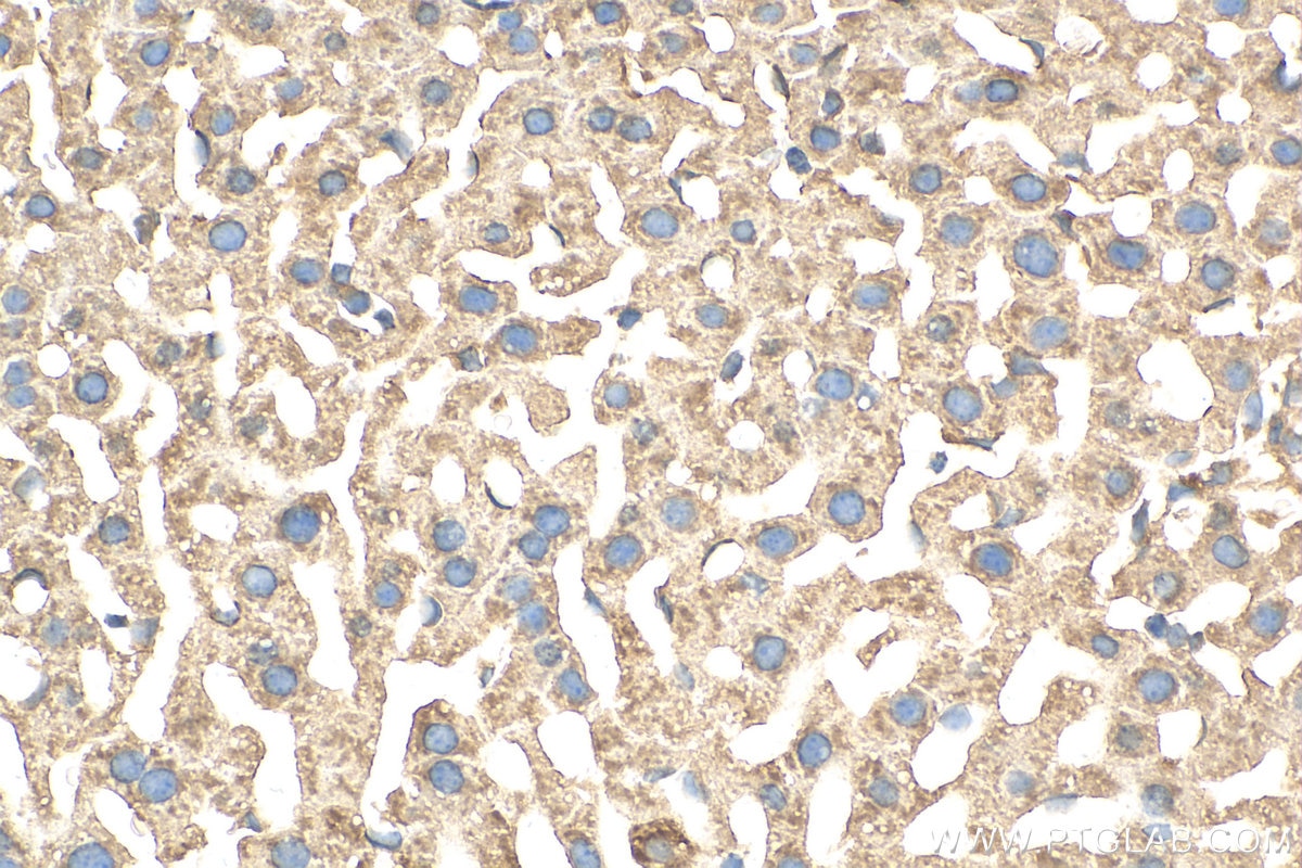 Immunohistochemistry (IHC) staining of mouse liver tissue using Glutamine Synthetase Polyclonal antibody (11037-2-AP)