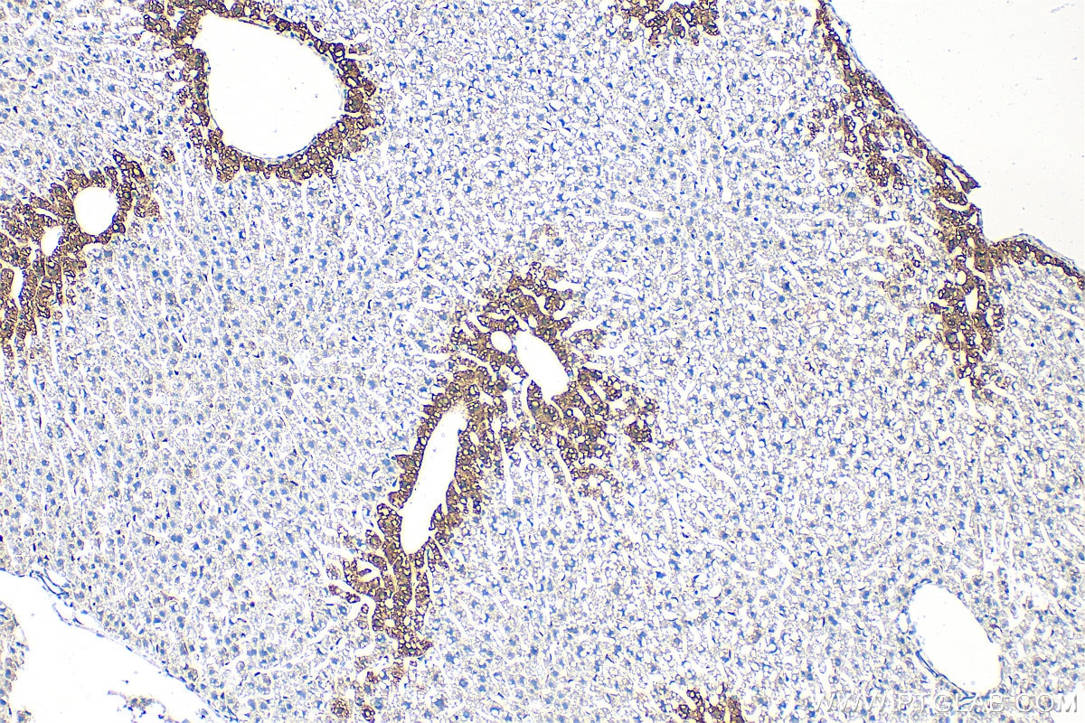 Immunohistochemistry (IHC) staining of mouse liver tissue using Glutamine Synthetase Polyclonal antibody (11037-2-AP)