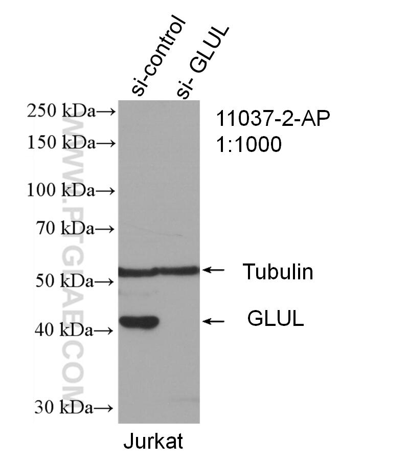 Western Blot (WB) analysis of Jurkat cells using Glutamine Synthetase Polyclonal antibody (11037-2-AP)