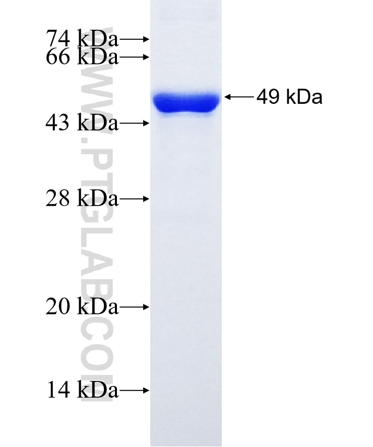 Glutamine synthetase fusion protein Ag6309 SDS-PAGE