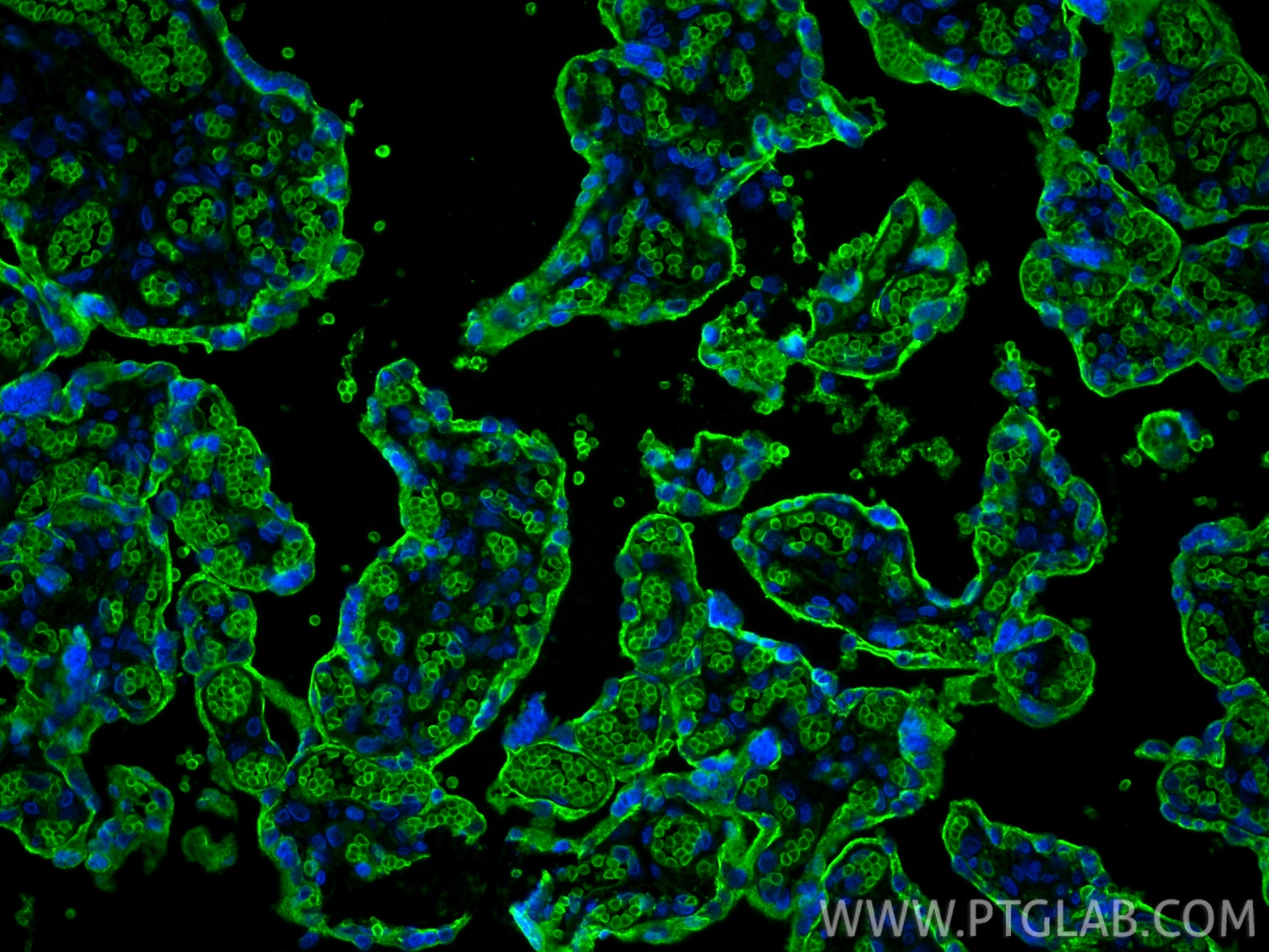 Immunofluorescence (IF) / fluorescent staining of human placenta tissue using GLUT1 Monoclonal antibody (66290-1-Ig)