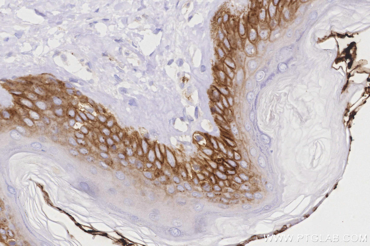 IHC staining of human skin using 66290-1-Ig Immunohistochemistry (IHC) staining of human skin tissue using GLUT1 Monoclonal antibody (66290-1-Ig)