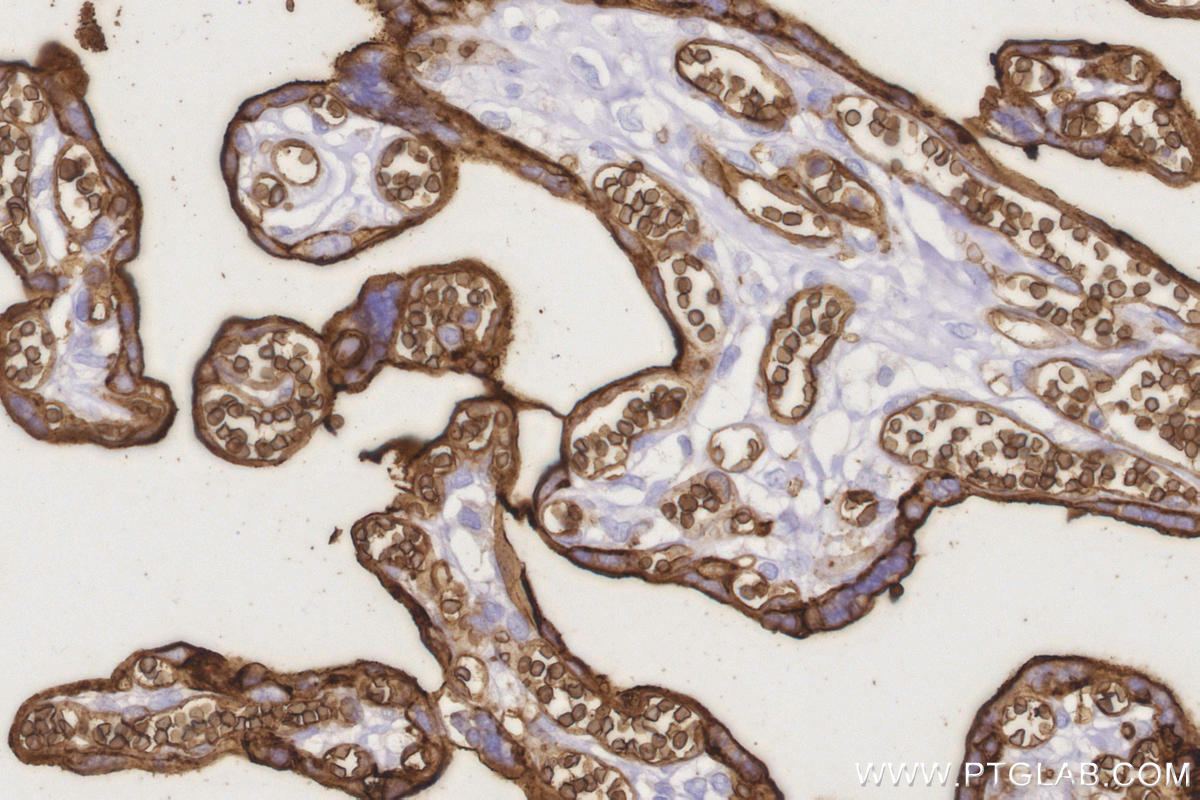 IHC staining of human placenta using 66290-1-Ig Immunohistochemistry (IHC) staining of human placenta tissue using GLUT1 Monoclonal antibody (66290-1-Ig)