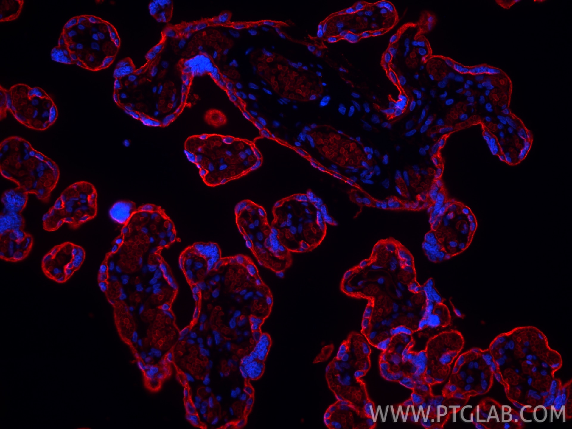 Immunofluorescence (IF) / fluorescent staining of human placenta tissue using CoraLite®594-conjugated GLUT1 Monoclonal antibody (CL594-66290)