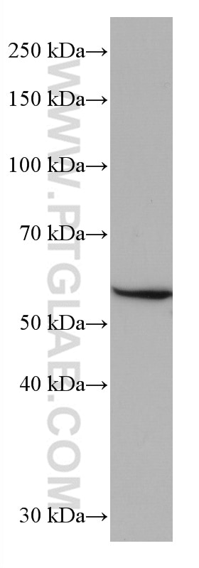 Western Blot (WB) analysis of HeLa cells using GLUT2 Monoclonal antibody (66889-1-Ig)