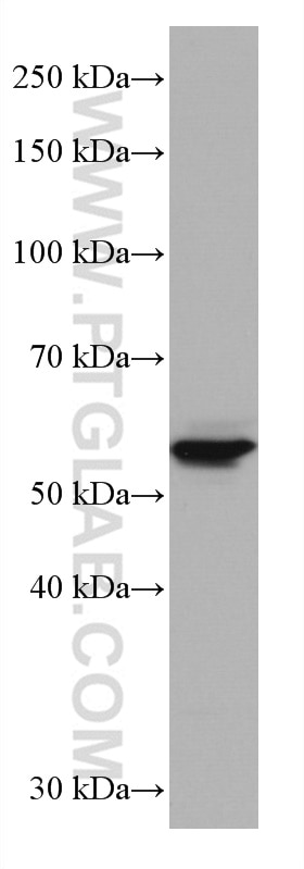 Western Blot (WB) analysis of 4T1 cells using GLUT2 Monoclonal antibody (66889-1-Ig)
