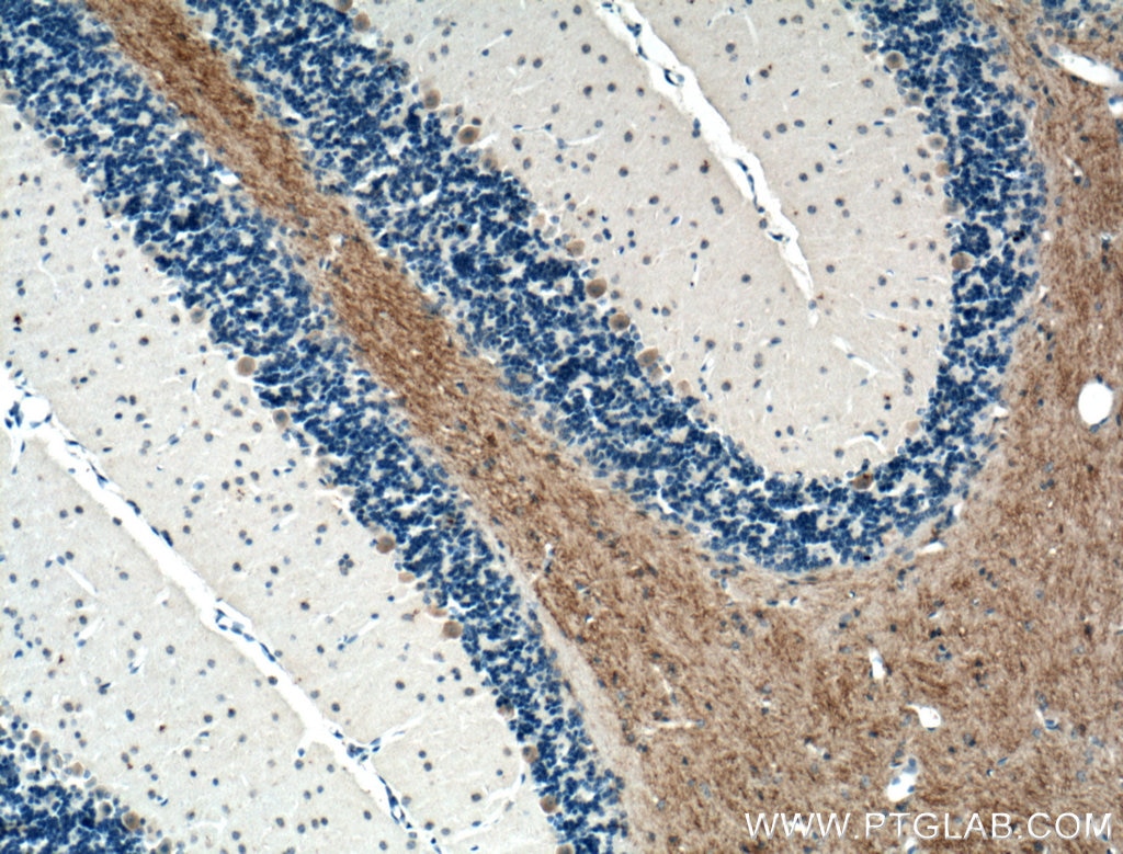 Immunohistochemistry (IHC) staining of mouse cerebellum tissue using GLUT4 Polyclonal antibody (21048-1-AP)