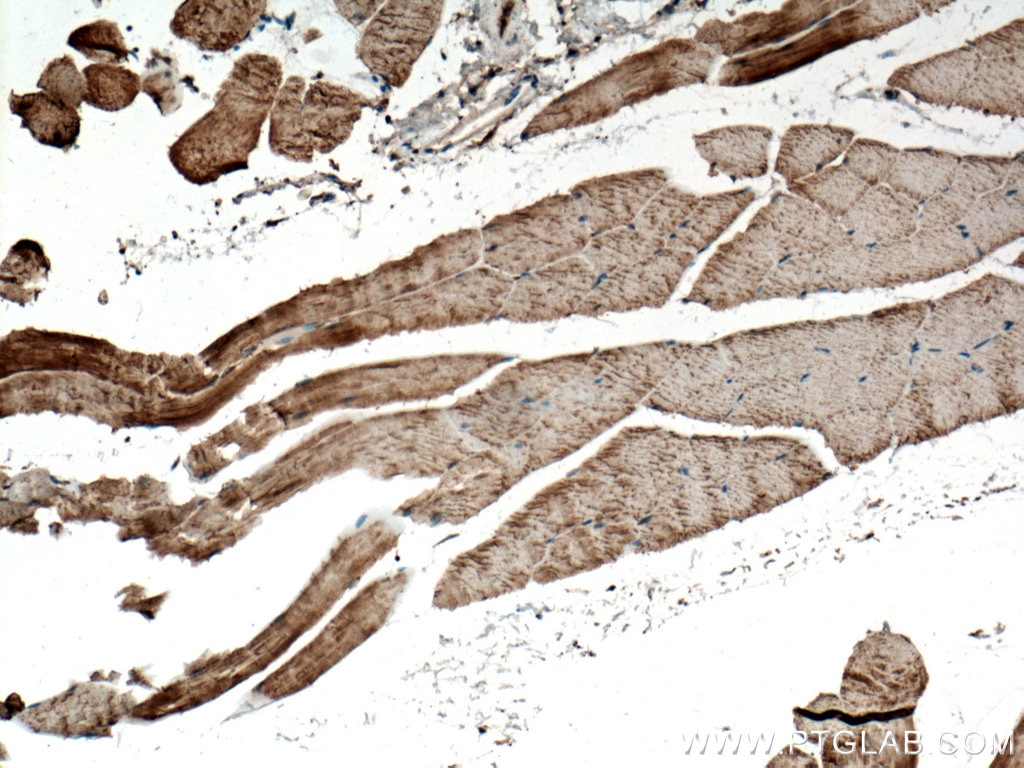 Immunohistochemistry (IHC) staining of mouse skeletal muscle tissue using GLUT4 Polyclonal antibody (21048-1-AP)