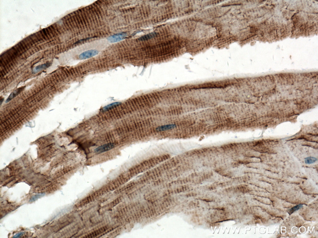 Immunohistochemistry (IHC) staining of mouse skeletal muscle tissue using GLUT4 Polyclonal antibody (21048-1-AP)