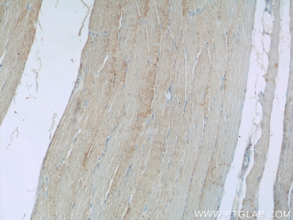 GLUT4 Polyclonal antibody