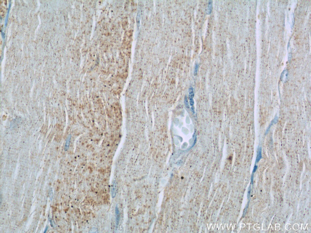 GLUT4 Polyclonal antibody