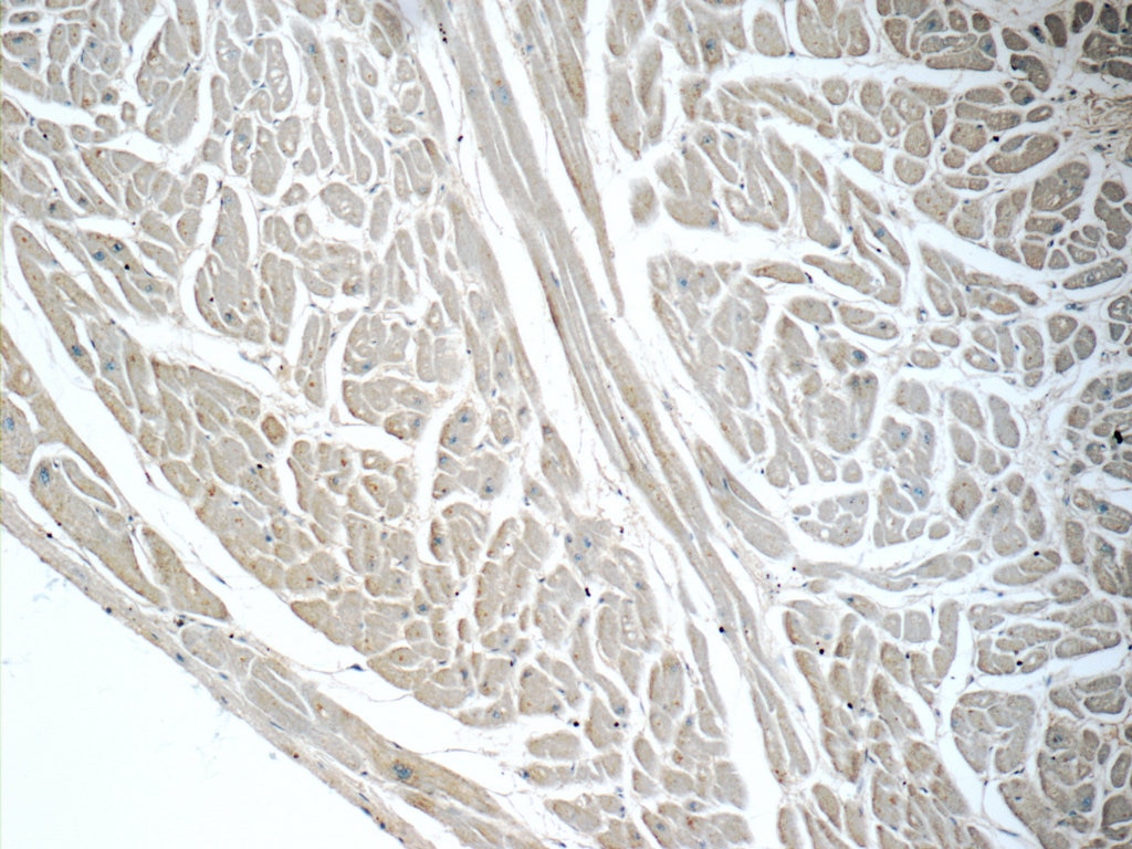 Immunohistochemistry (IHC) staining of human heart tissue using GLUT4 Polyclonal antibody (21048-1-AP)
