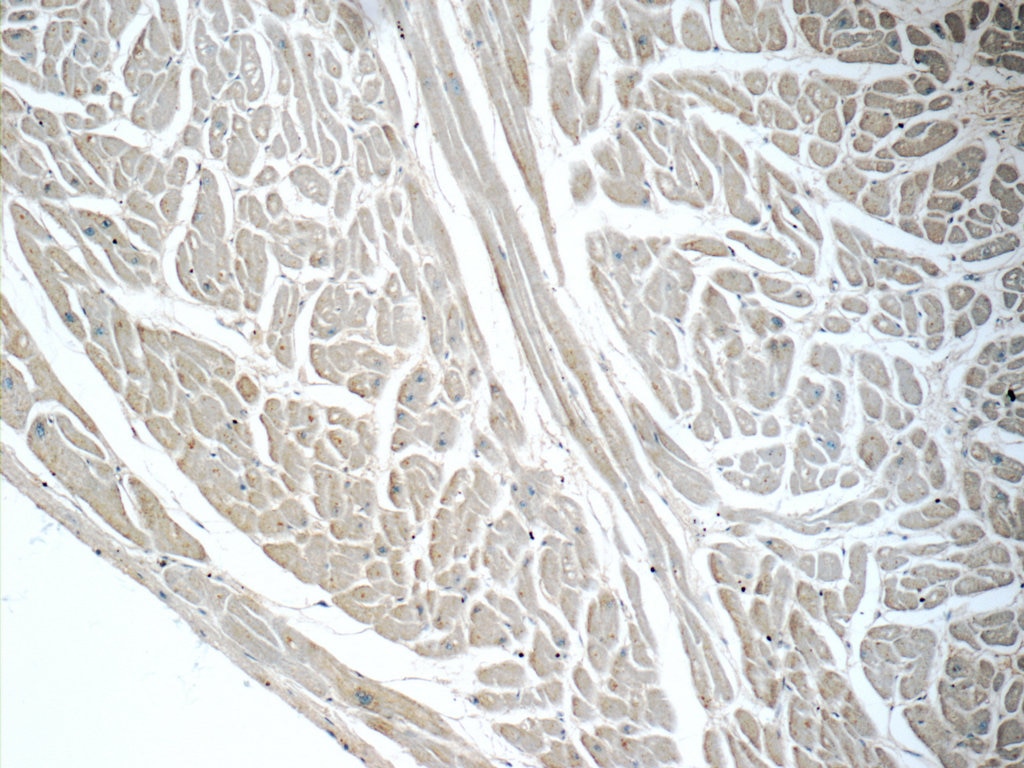 IHC staining of human heart using 21048-1-AP