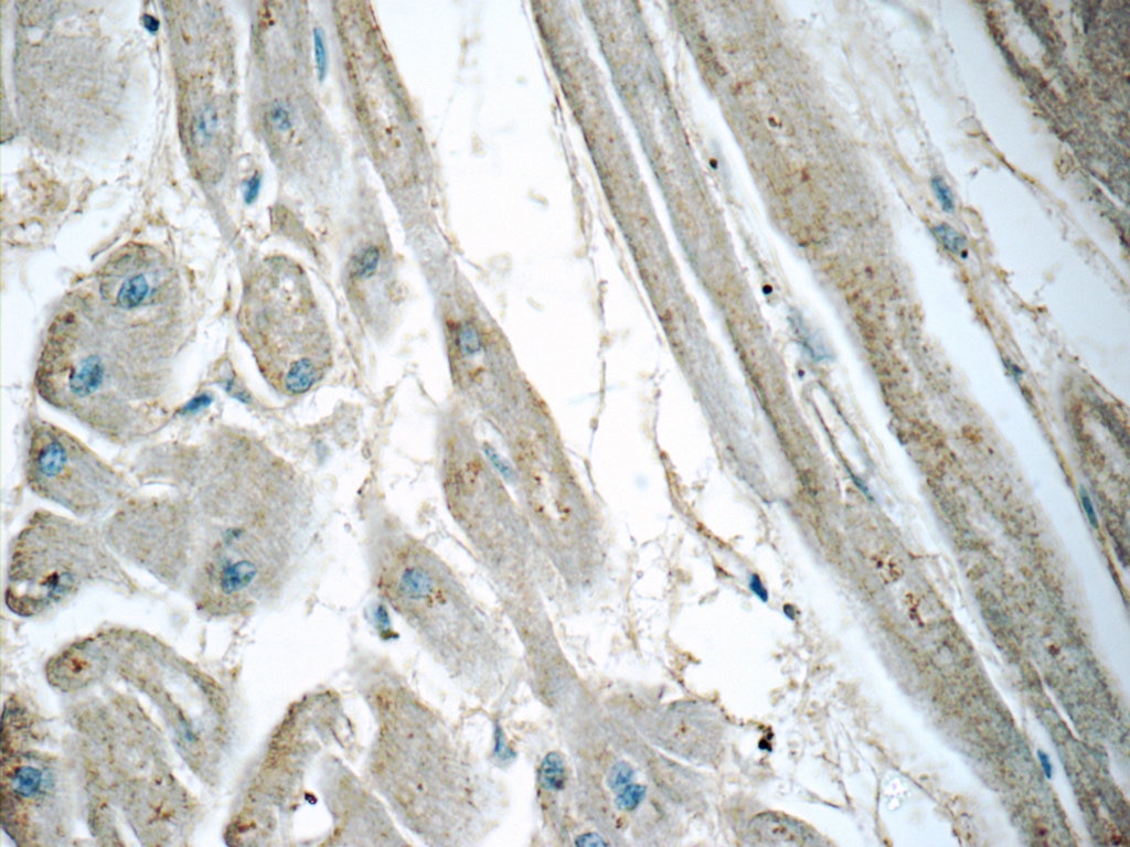 Immunohistochemistry (IHC) staining of human heart tissue using GLUT4 Polyclonal antibody (21048-1-AP)