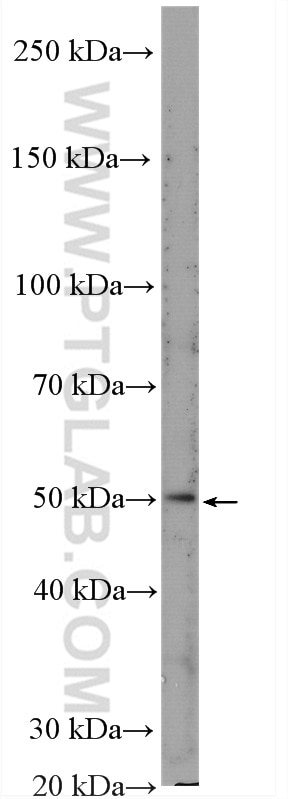 Western Blot (WB) analysis of rat brain tissue using GLUT4 Polyclonal antibody (21048-1-AP)