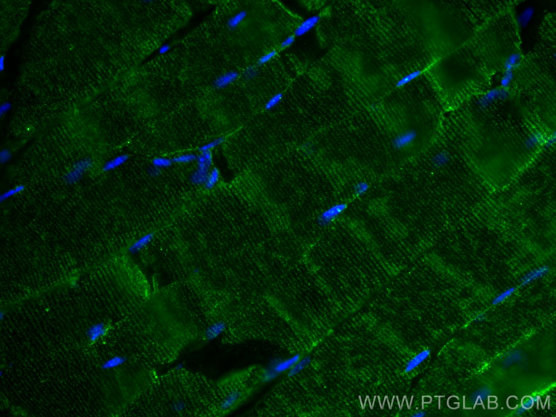 Immunofluorescence (IF) / fluorescent staining of mouse skeletal muscle tissue using GLUT4 Monoclonal antibody (66846-1-Ig)