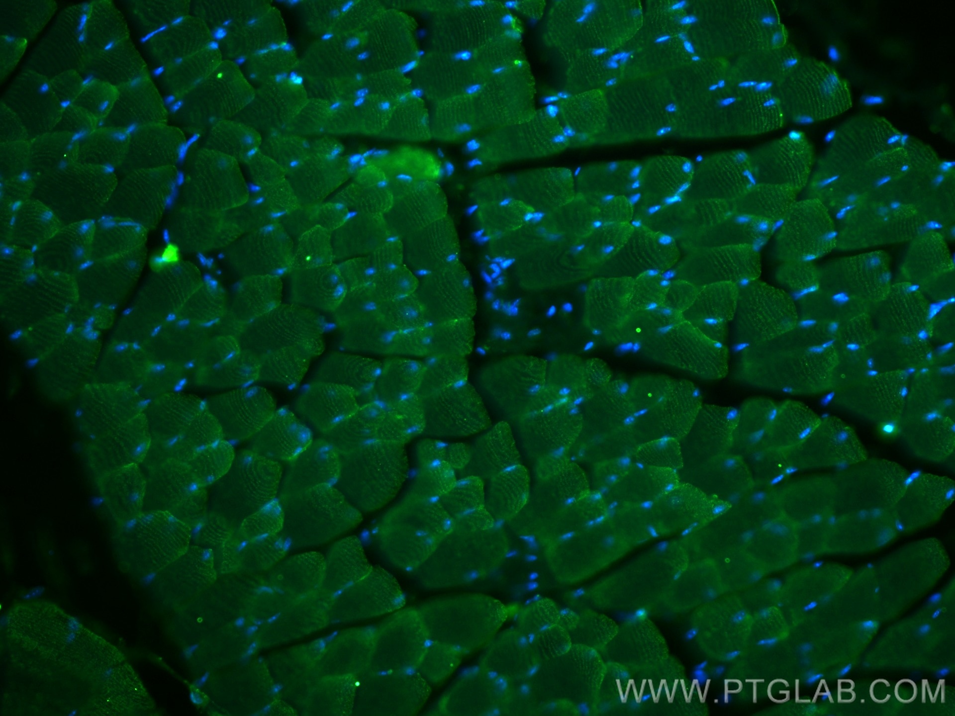 Immunofluorescence (IF) / fluorescent staining of mouse skeletal muscle tissue using GLUT4 Monoclonal antibody (66846-1-Ig)