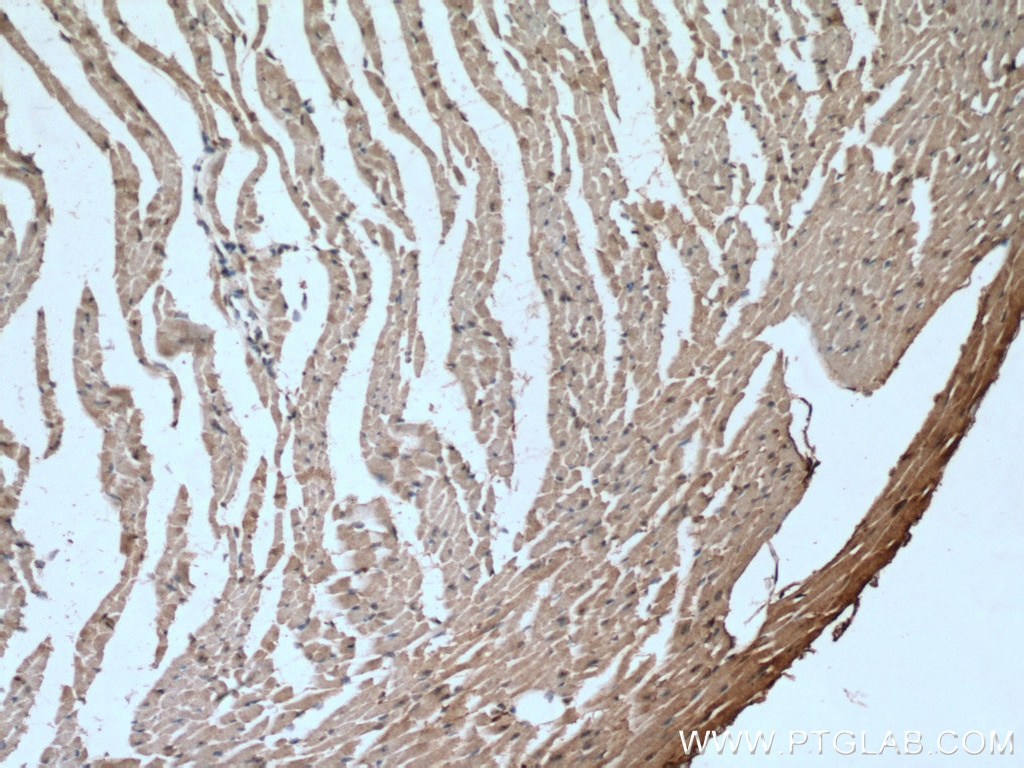 Immunohistochemistry (IHC) staining of mouse heart tissue using GLUT4 Monoclonal antibody (66846-1-Ig)