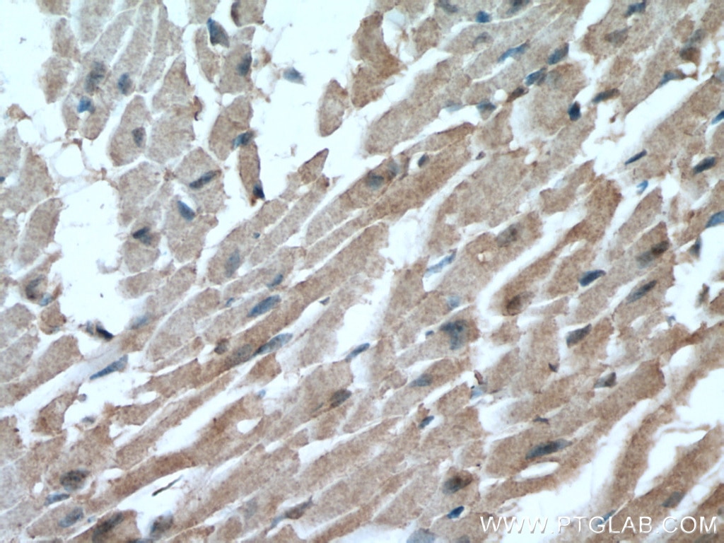 Immunohistochemistry (IHC) staining of mouse heart tissue using GLUT4 Monoclonal antibody (66846-1-Ig)